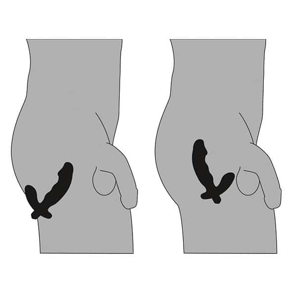 Vibrador de Próstata